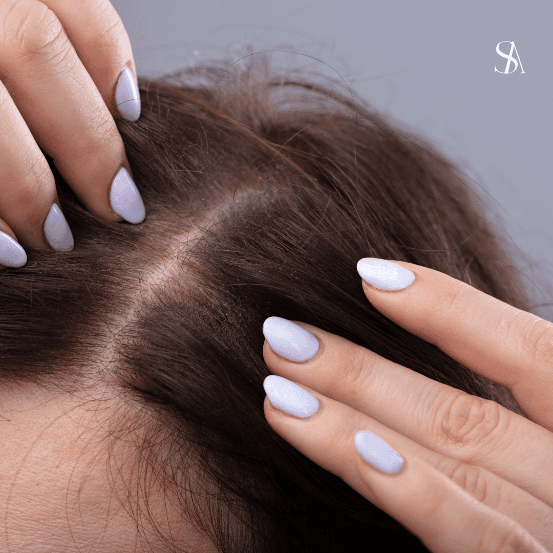 Genetic Factor Influencing Hair Growth and Hair Loss