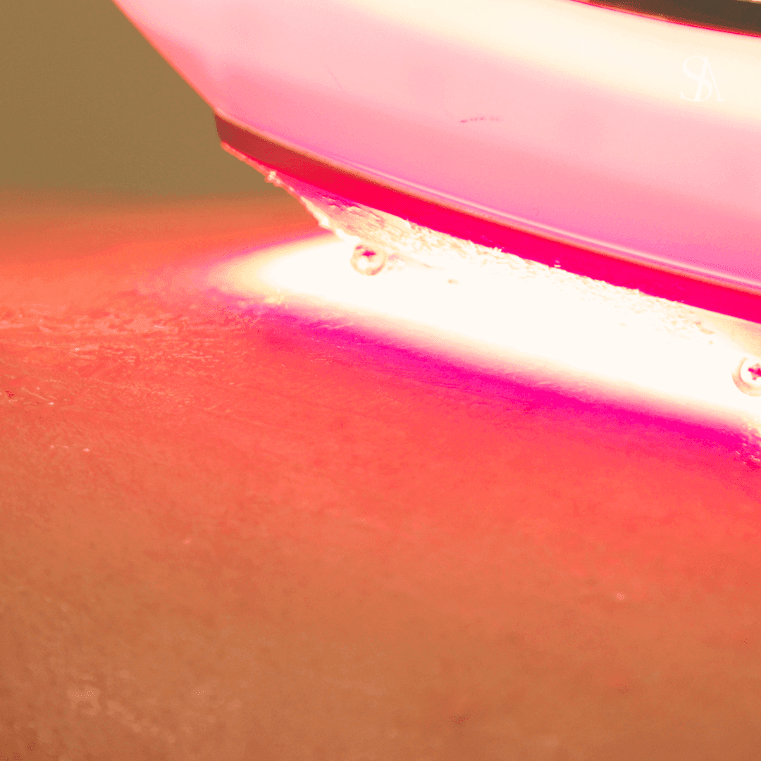 Laser Focus: At-Home Cold Lasers