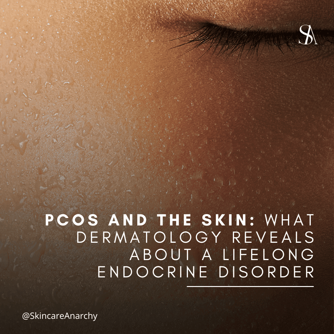 PCOS and the Skin: What Dermatology Reveals About a Lifelong Endocrine Disorder