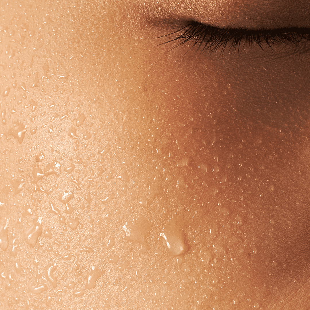 PCOS and the Skin: What Dermatology Reveals About a Lifelong Endocrine Disorder